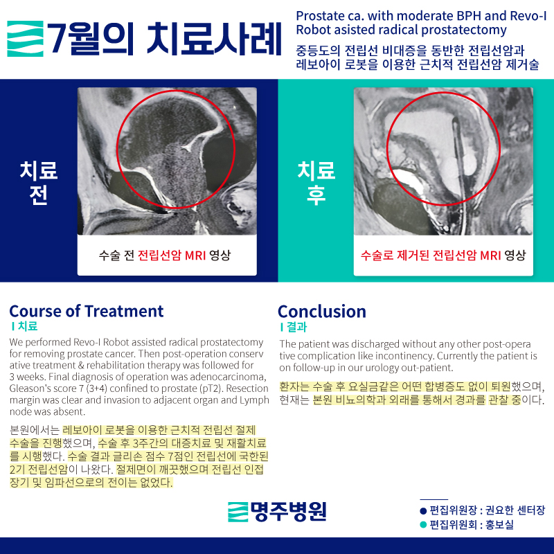 240626-7%25EC%259B%2594%25EC%259D%2598%25EC%25B9%2598%25EB%25A3%258C%25EC%2582%25AC%25EB%25A1%2580-%25EC%25B9%25B4%25EB%2593%259C%25EB%2589%25B4%25EC%258A%25A42.jpg